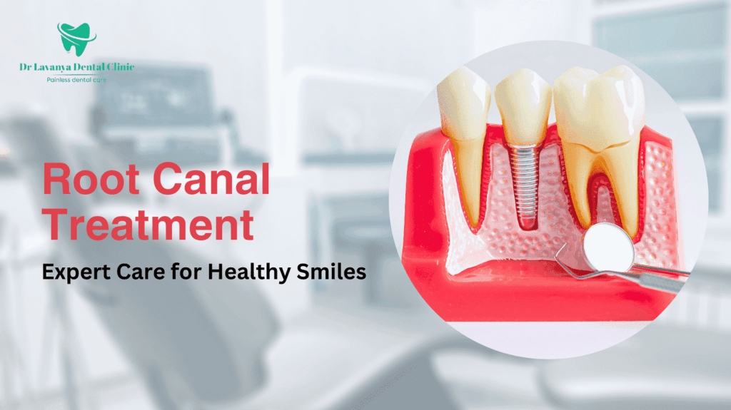 Root canal treatment in Hyderabad